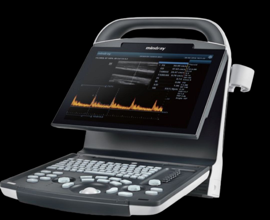 image of DP -10 Digital Ultrasonic Diagnostic Imaging System