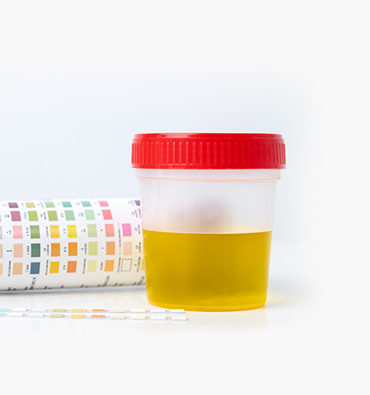 Urine Reagent Strips